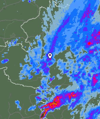 Radar