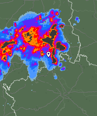 Radar