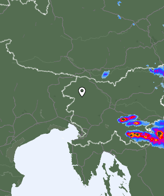 Radar