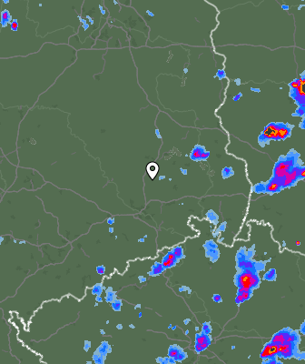 Radar
