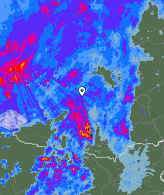 Radar