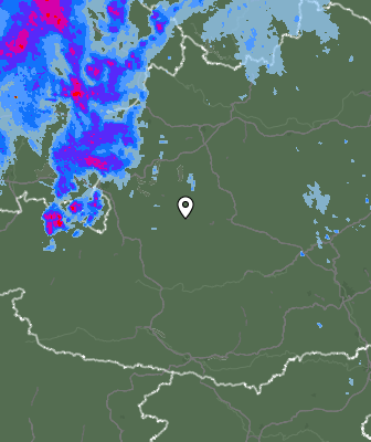 Radar