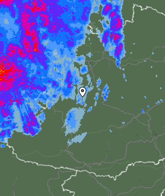 Radar
