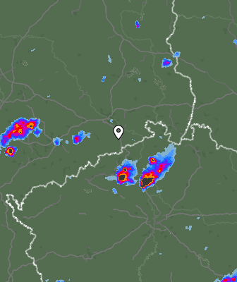 Radar