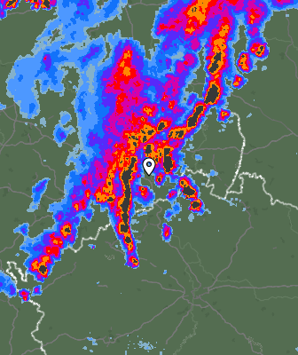 Radar