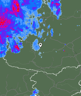Radar