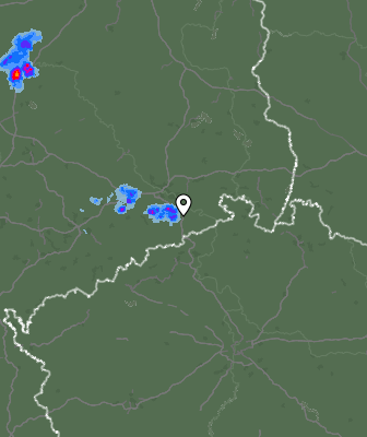 Radar