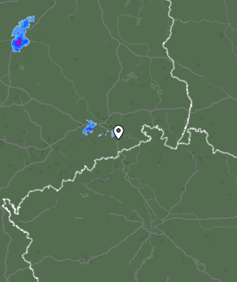 Radar