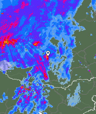 Radar