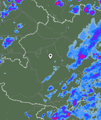 Radar