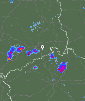 Radar