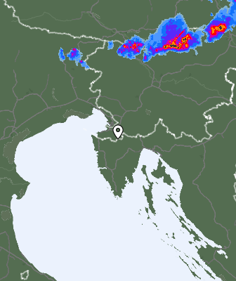 Radar
