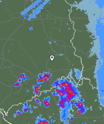 Radar