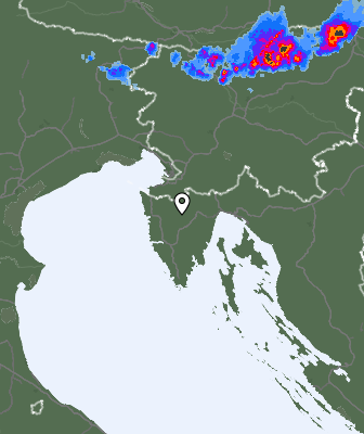 Radar