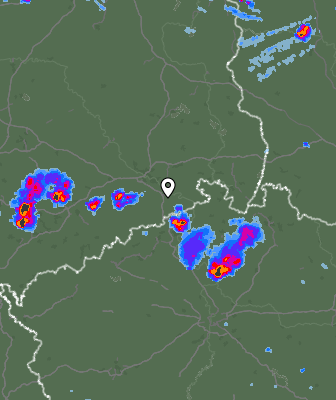 Radar