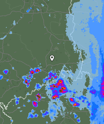 Radar