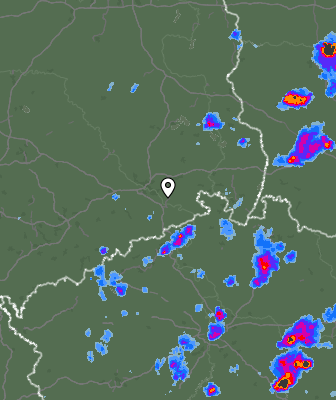 Radar