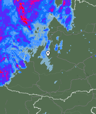 Radar