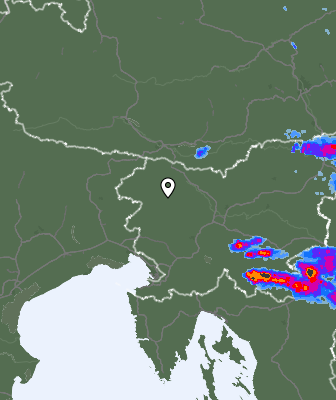 Radar