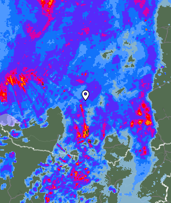 Radar