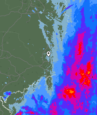 Radar