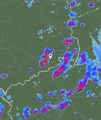 Radar