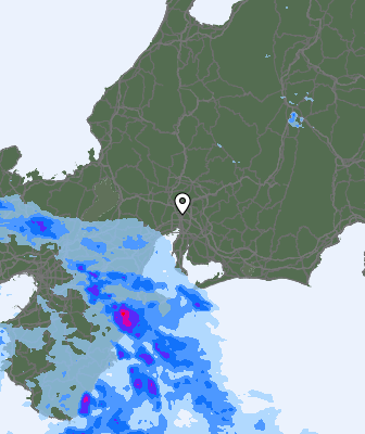 Radar