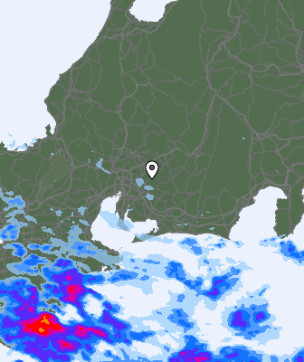 Radar