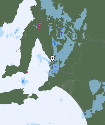 Radar