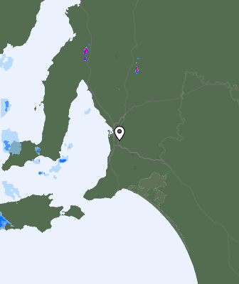 Radar