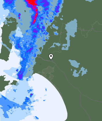 Radar