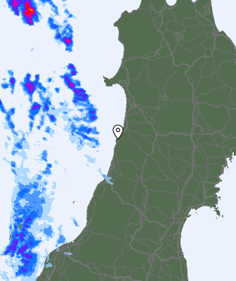 Radar
