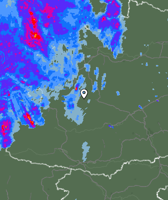 Radar