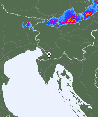 Radar
