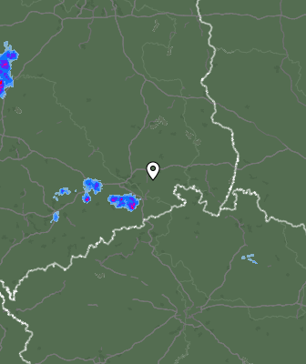 Radar