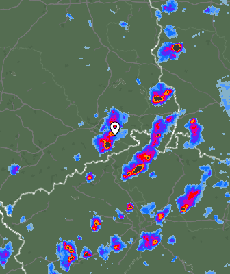 Radar