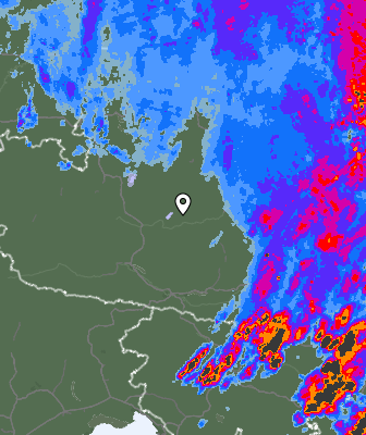 Radar