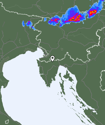 Radar