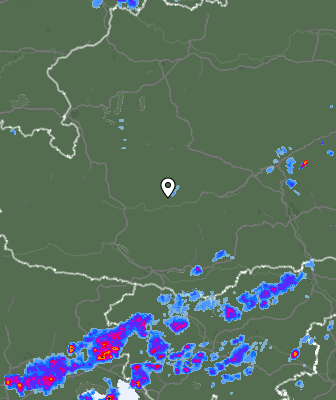 Radar