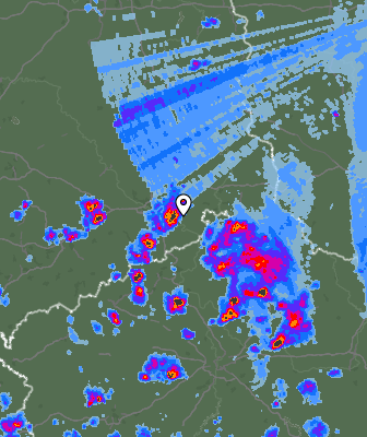 Radar