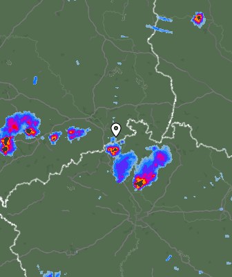 Radar