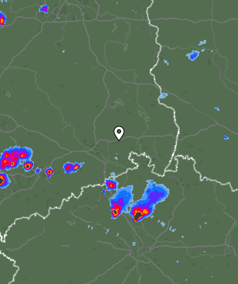 Radar