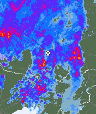 Radar