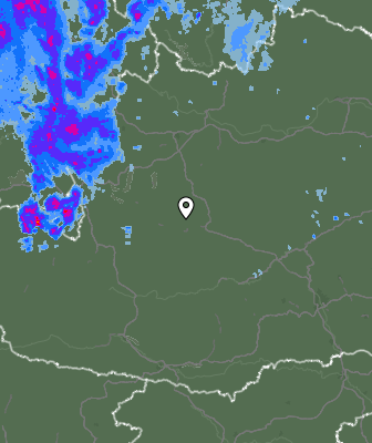Radar