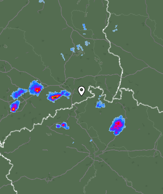 Radar