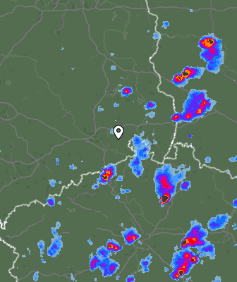 Radar