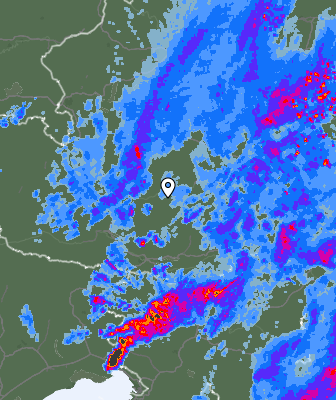 Radar