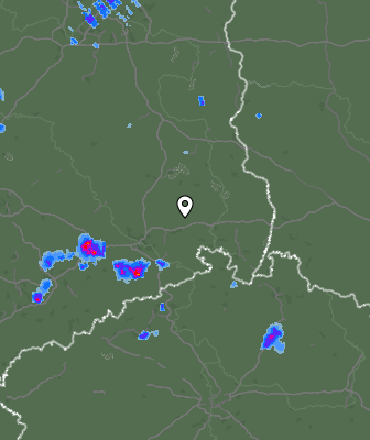 Radar