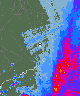 Radar