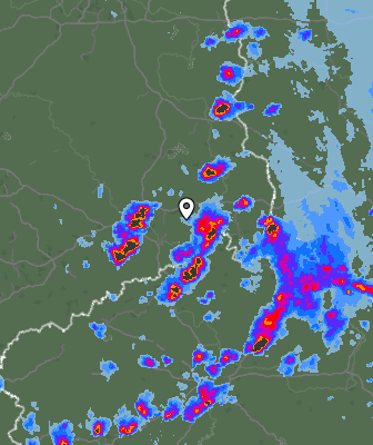 Radar